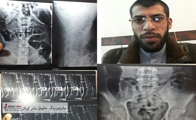 ممانعت از مرخصی درمانی و اعزام احمد کعبی برای عمل جراحی در زندان کرمان
