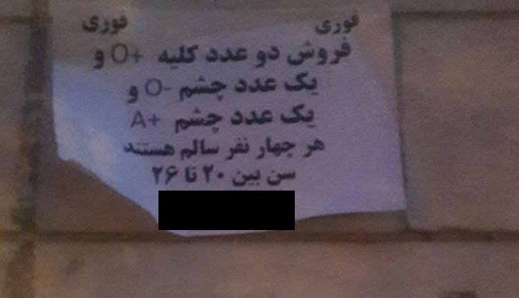 فروش کلیه و چشم